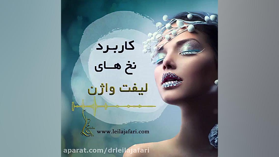 همه چیز درباره کاربرد نخ های لیفت واژینال دکتر لیلا جعفری