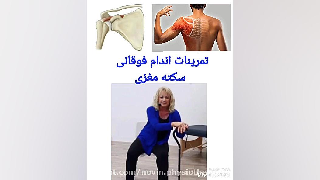 سکته مغزی توانبخشی و فیزیوتراپی اندام فوقانی فیزیوتراپی نوین قم اصلاح فرم صورت