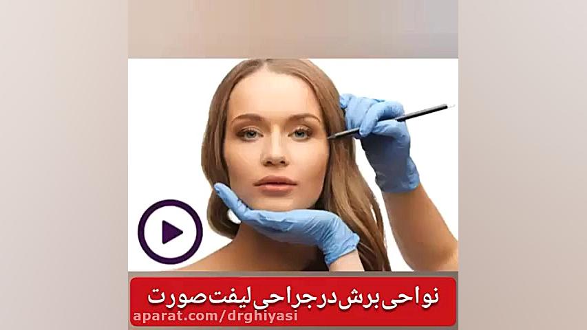 نواحی برش در جراحی لیفت صورت دکتر سینا غیاثی حافظی