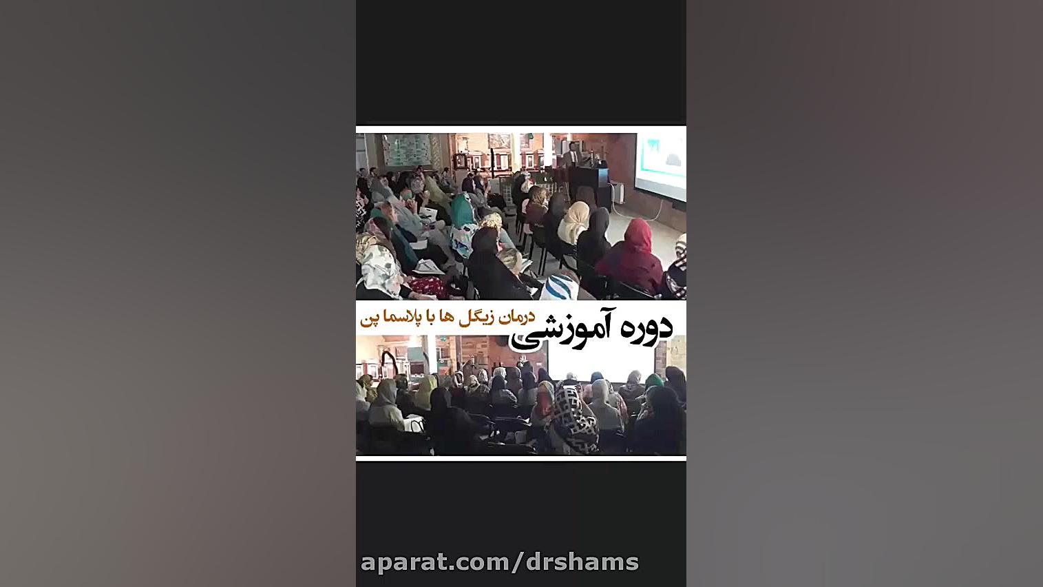 درمان زگیل با پلاسما پن دکتر شیرین شمس جراح و متخصص زنان و زایمان