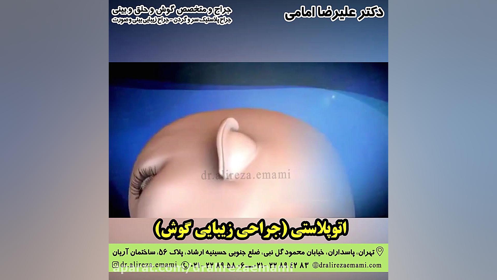 جراحی زیبایی گوش بیماری سندروم باتن