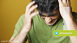 طاسی در آقایان  ریزش مو