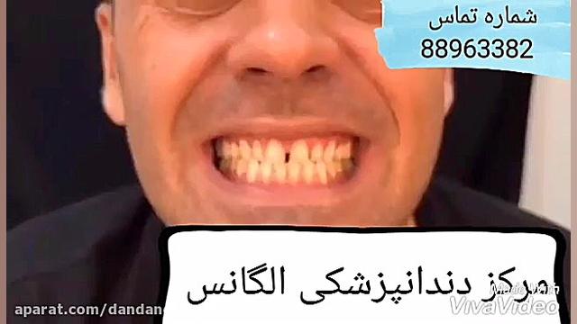 معروفترین دندانپزشک زیبایی | معروفترین متخصص دندانپزشکی زیبایی دستگاه DNA-Chip