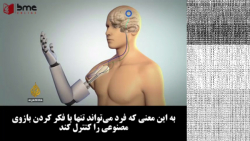 هر آنچه که باید در مورد بازوی مصنوعی بدانیم! هر آنچه که باید در مورد ...