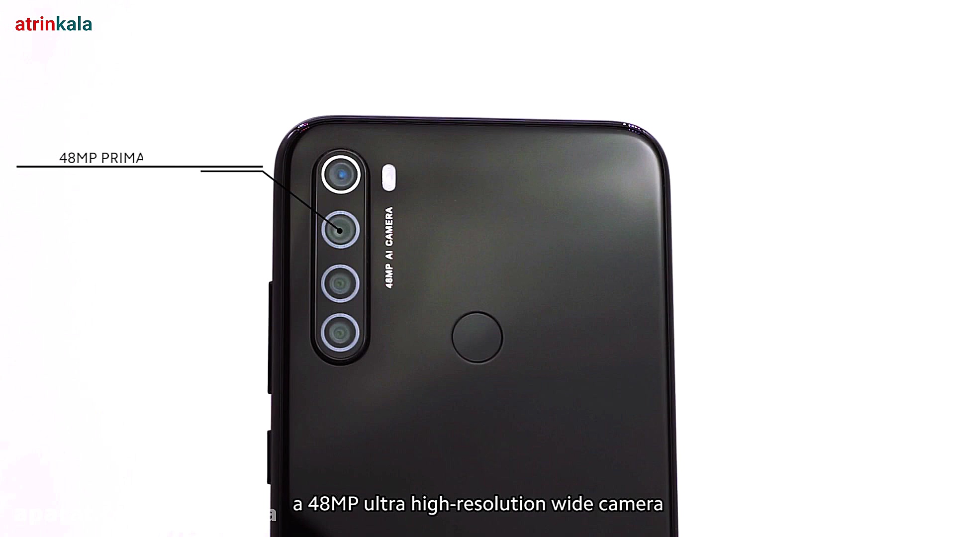 جعبه گشایی گوشی شیاومی redmi note 8 جراحی لثه