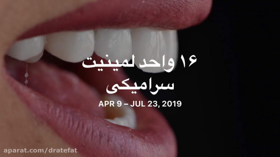 16 واحد لمینیت سرامیکی ،اصفهان،دکتر محمد عاطفت متخصص دندانپزشکی ترمیمی زیبایی دکتر محمد عاطفت متخصص ترمیمی و زیبایی اصفهان