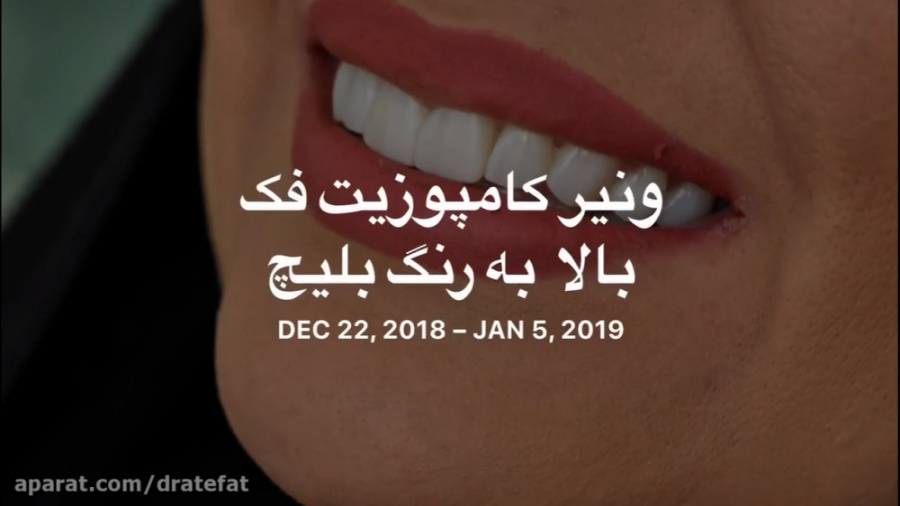 لمینیت سرامیکی دندان و بریج دندانی در اصفهان توسط دکتر محمد عاطفت دکتر محمد عاطفت متخصص ترمیمی و زیبایی اصفهان