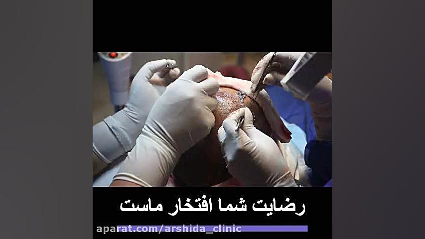 فیلم روش های کاشت مو | کلینیک آرشیدا | 02188195746 ANA