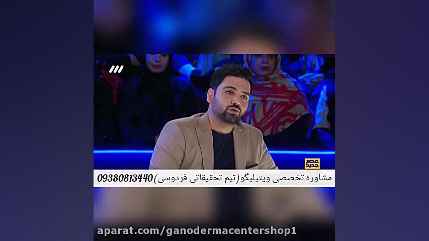 معرفی موثرترین روش درمان ویتیلیگو در برنامه عصر جدید زمان207ثانیه