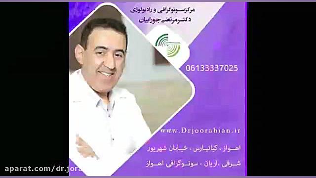 فیبرواسکن در کبد چرب لیزر موهای زائد