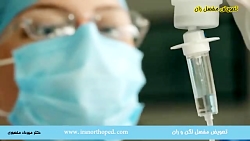 جراحی مفصل مصنوعی لگن چیست جراحی مفصل مصنوعی لگن چ...