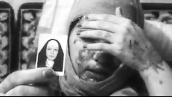 تصاویری از ماجرای اسید پاشی اص...