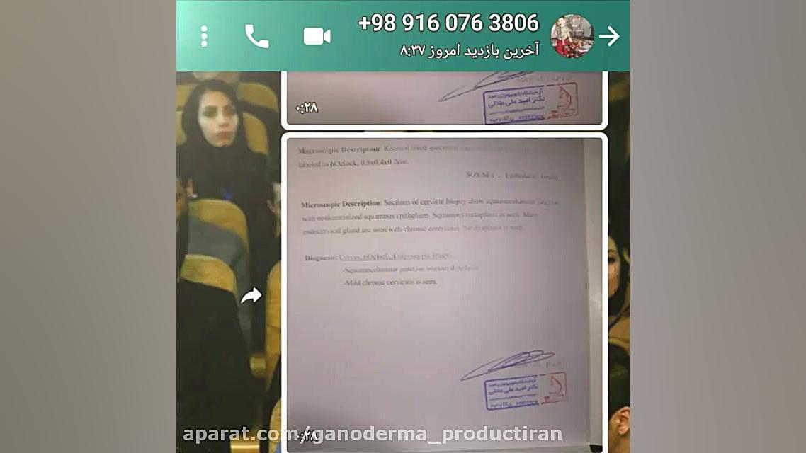 پیشگیری از بیماری های ویروسی در زمستان و فصول دیگر اچ پی وی اکستنشن تاج دندان