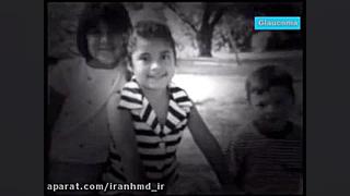 بیماری آب سیاه چشم دندان شیری