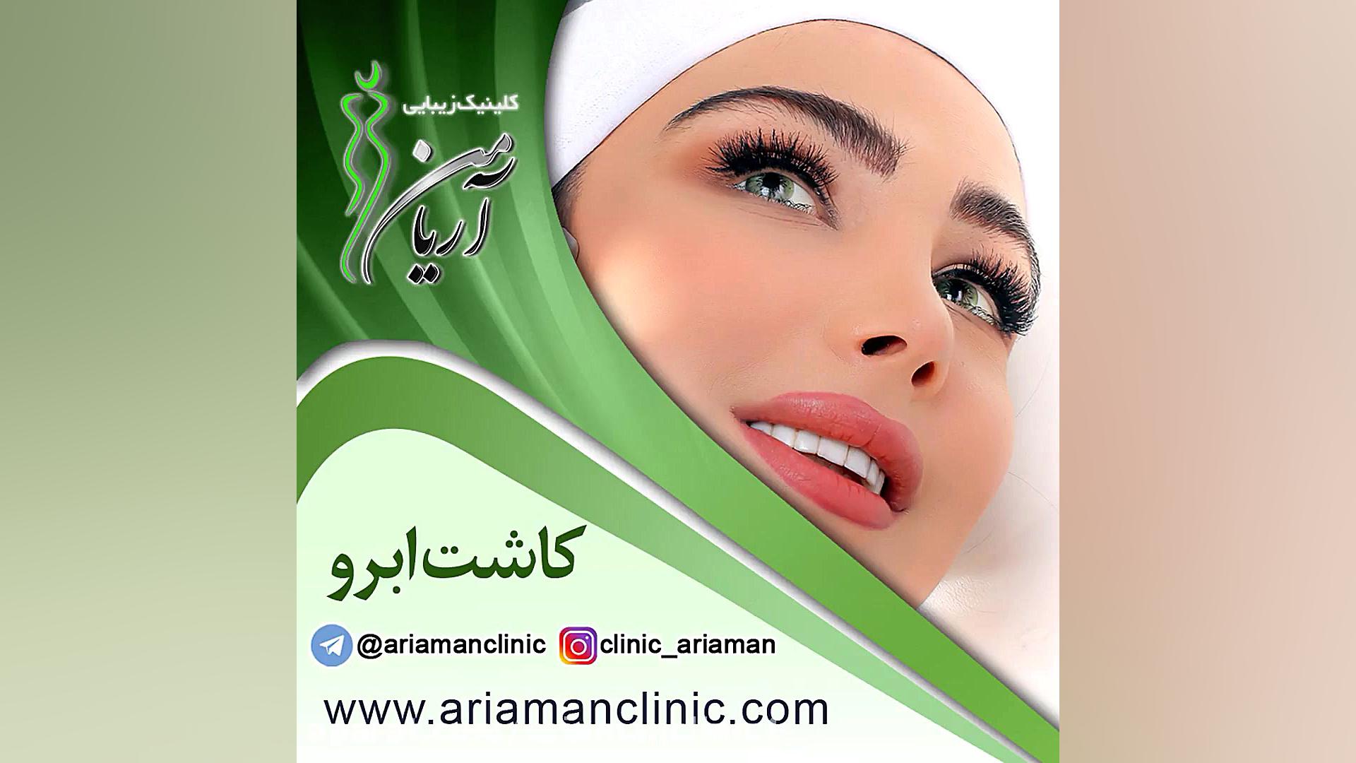 فیلم کاشت ابرو در کلینیک کاشت مو و زیبایی آریامن نقص اسیدهای چرب زنجیره متوسط