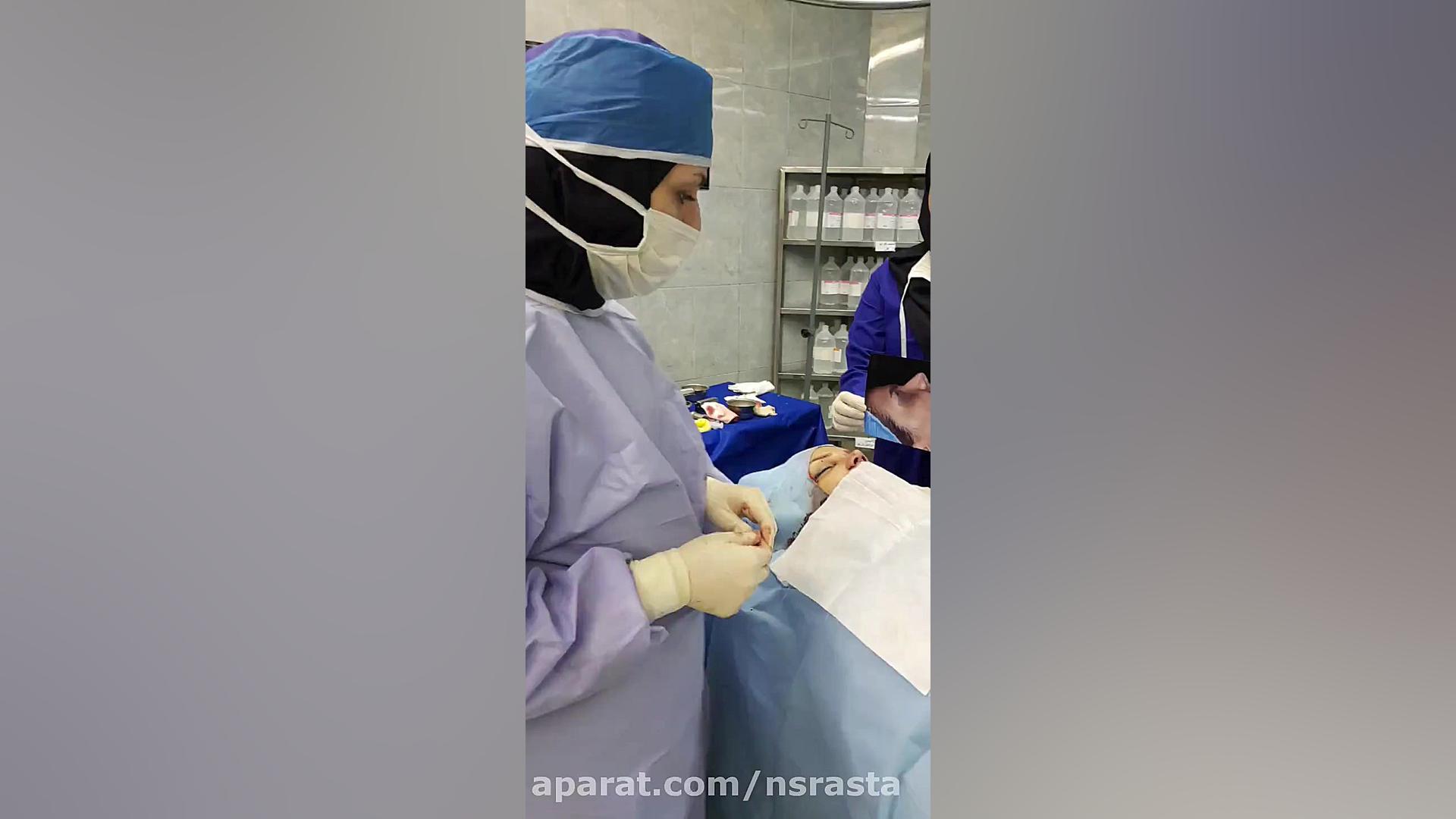 جراحی بینی باز اتاق عمل دکترراستا 09337174804 رفع چین و چروک