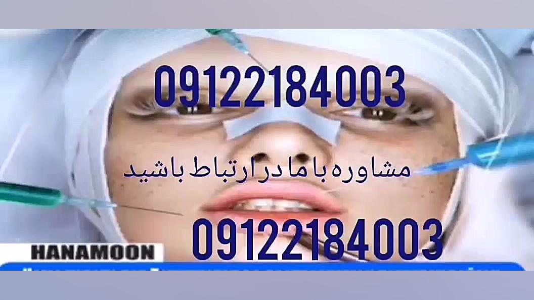 بهترین کرم ضدلک هانامون کلینیک لیزر