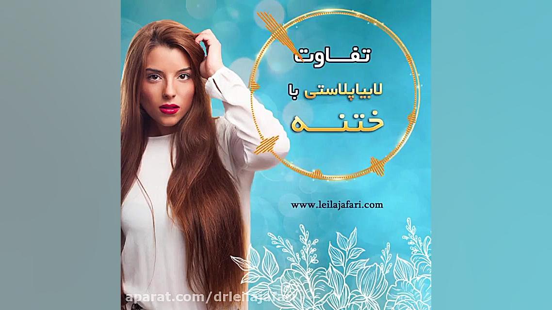 صحبتهای دکتر جعفری درباره تفاوت ختنه و لابیاپلاستی دکتر لیلا جعفری