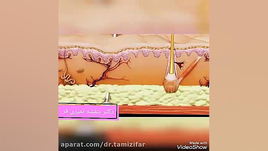 تزریق بوتاکس جهت رفع و کم تر شدن چین و چروک دکتر بنفشه تمیزی فر
