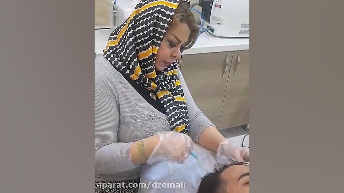 کربوکسی تراپی و مزوتراپی موهای سر دکتر فرحناز زینعلی - متخصص پوست، مو، زیبایی زنجان