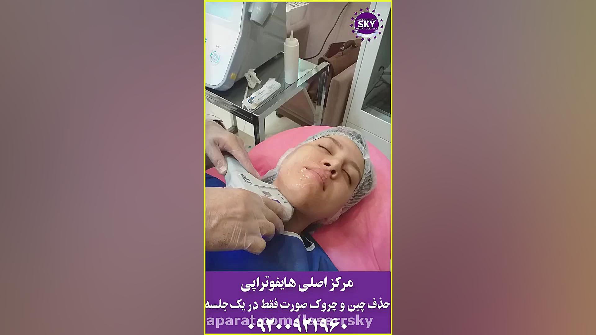 هایفوتراپی .جوانسازی و رفع چین و چروک صورت و بدن بیماری اورنیتین ترانس کاربامیلاز