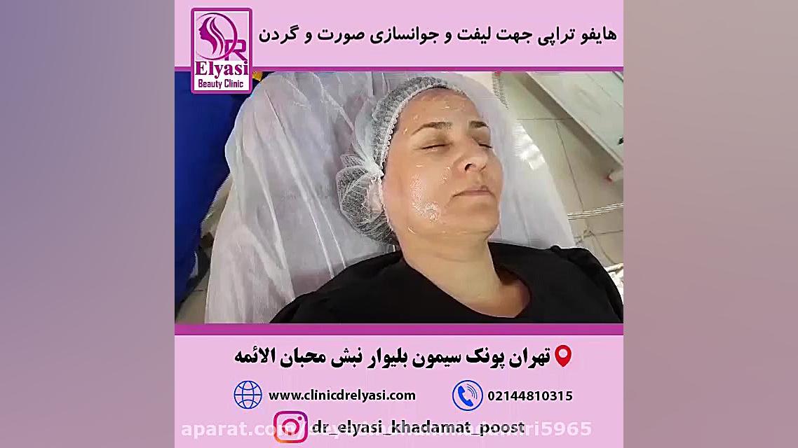 هایفوتراپی صورت و گردن PVRژنتیک پزشکی پیشرفته