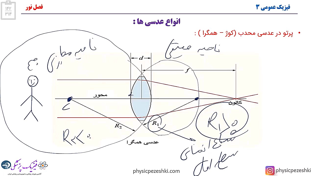قسمتی از تدریس مفهومی فیزیک عمومی سه، فصل نور _ عدسی - فیزیک پزشکی برداشتن زگیل