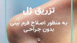 تزریق ژل به منظور اصلاح فرم بی...