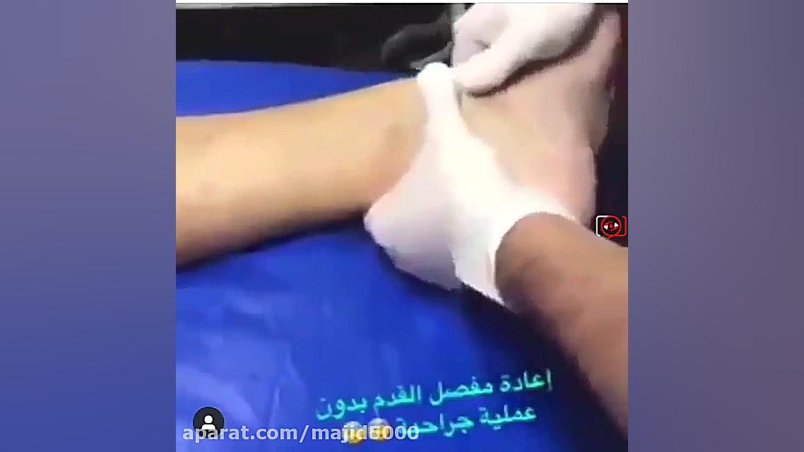 لحظه جا انداختن پای آندره گومز بازیکن تیم اورتون در اتاق عمل دندان پیش