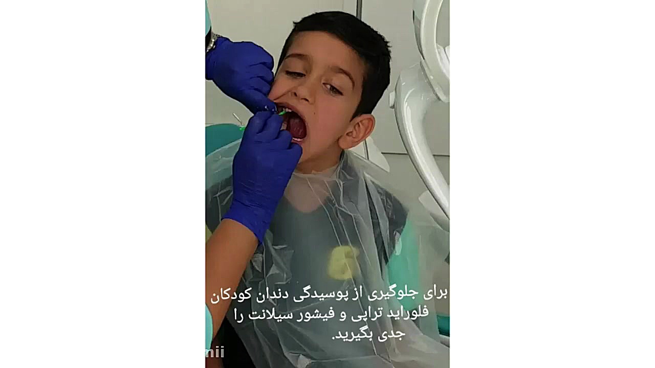 نگهداری از دندان کودک کانال رسمی دکتر مهدی سمیعی