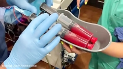 چربی استخراج شده با پال