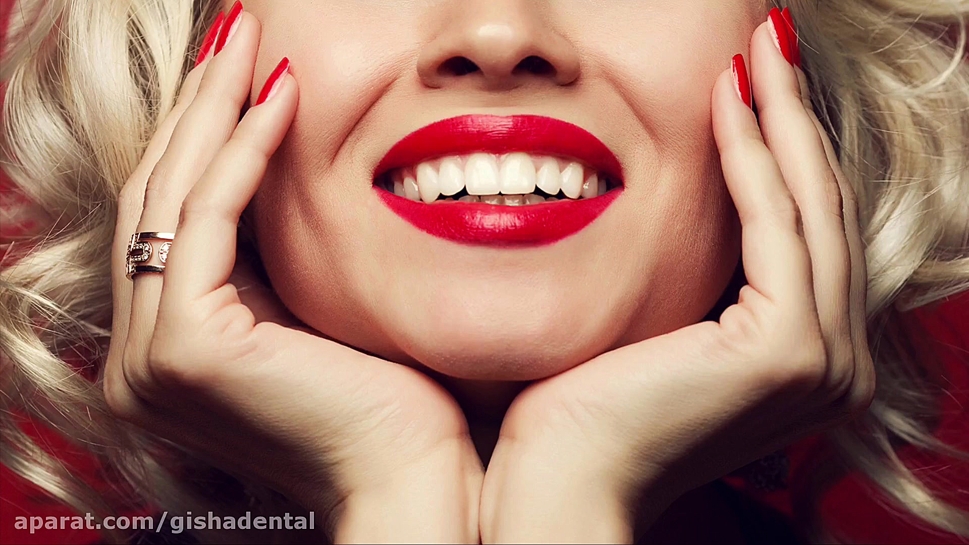 اشتباهات رایج در لمینت دندان کلینیک دندانپزشکی دکتر عزیز گشاده رو
