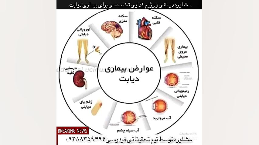 پک های درمانی و کنترل دیابت... بلیچینگ دندان