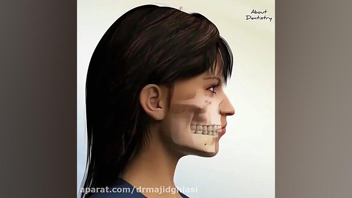 مشکلات فک و دندان-دکترمجیدقیاسی-دندانپزشک زیبایی مشهد لاروتریکتینیب