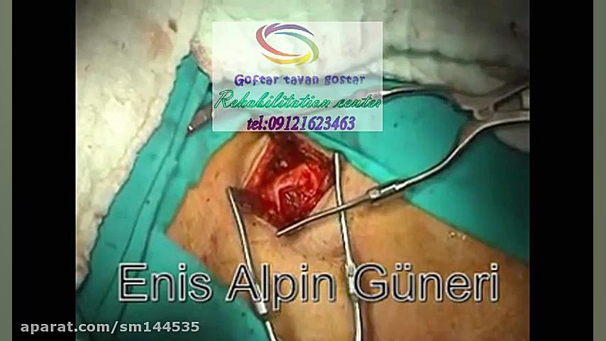 برترین کلینیک گفتاردرمانی09121623463 | تهران شهرک امید خیابان ولیعصر تزریق چربی