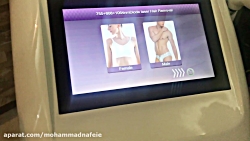 فيلم ليزر سه طول موج آيس كوئين...