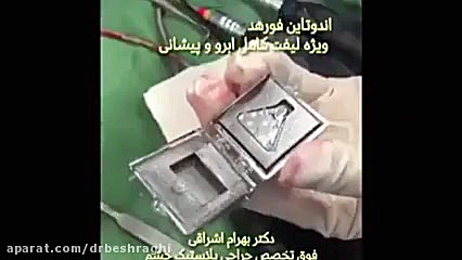 روند لیفت اندوسكوپى پیشانى و ابرو با اندوتین ایم‌دولیموماب