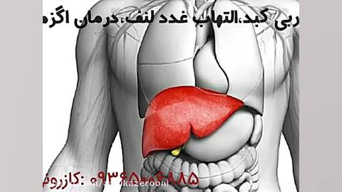 عادل کازرونی#طب سنتی#درمان_چرب_کبد# کمند امیرسلیمانی