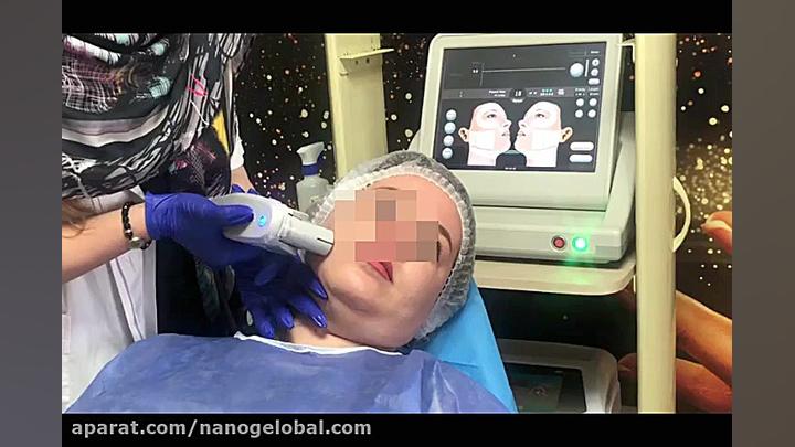 هایفو تراپی بیماری استئوجنز ایمپرفکتا