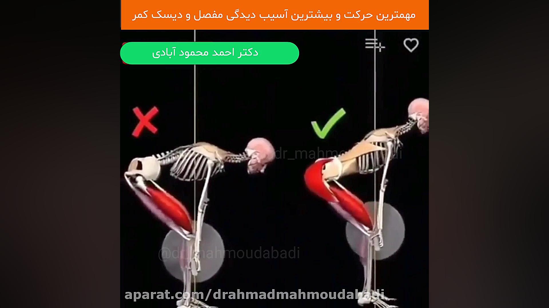 دیسک کمر دکتر احمد محمودابادی
