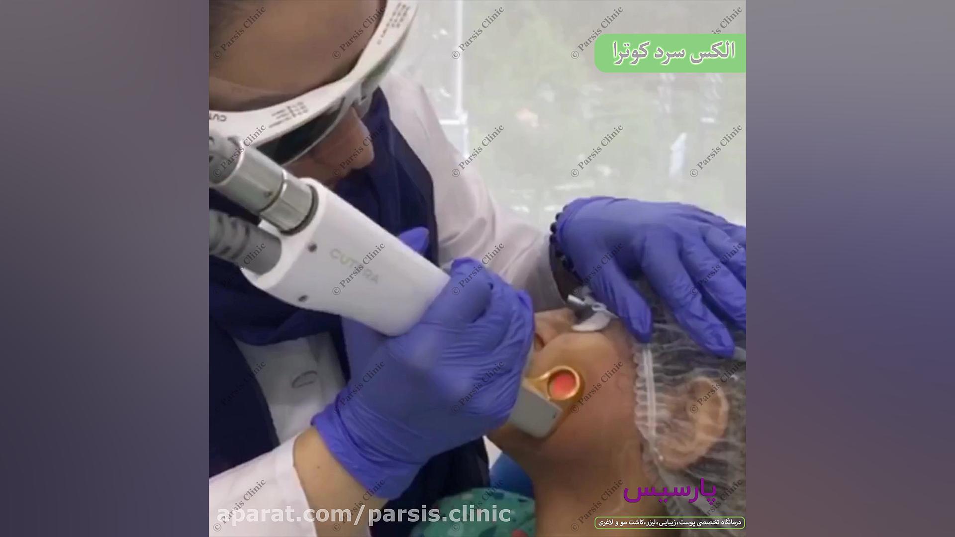 الکس سرد کوترا کلینیک تخصصی پوست،زیبایی،لیزر و کاشت مو پارسیس