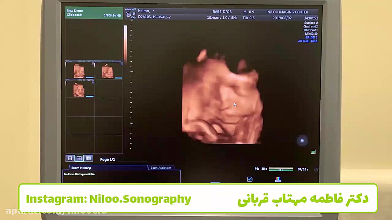 بینایی و شنوایی جنین گیم‌پلی کله‌خراب