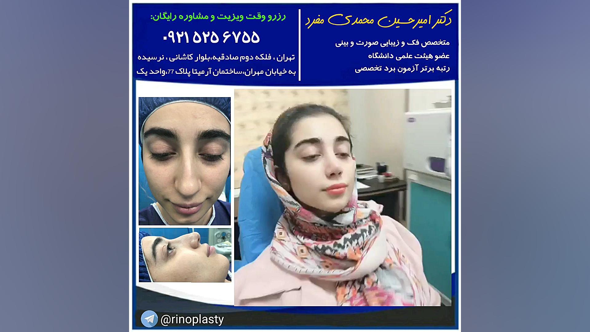 عمل جراحی زیبایی بینی (دکتر امیرحسین محمدی مفرد) دکتر امیر حسین محمدی مفرد
