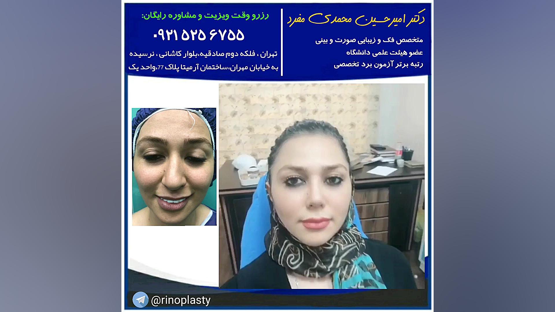 عمل جراحی زیبایی بینی (دکتر امیرحسین محمدی مفرد) دکتر امیر حسین محمدی مفرد