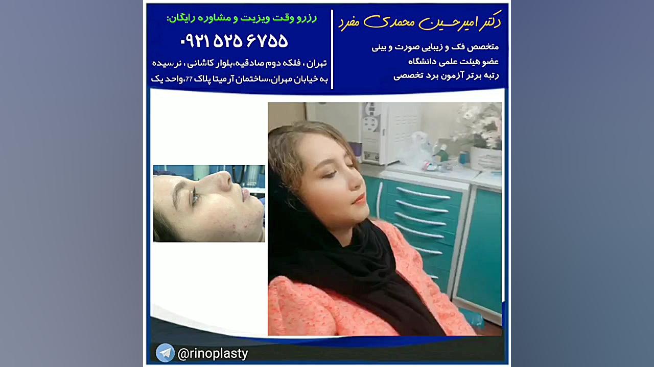 عمل جراحی زیبایی بینی (دکتر امیرحسین محمدی مفرد) دکتر امیر حسین محمدی مفرد