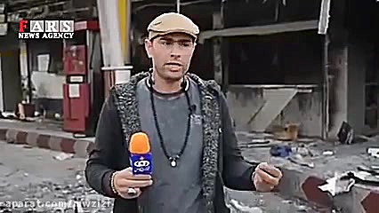 آتش زدن پمپ بنزین و سکته قلبی یکی از کارگران آن ترمیم لبخند لثه‌ای