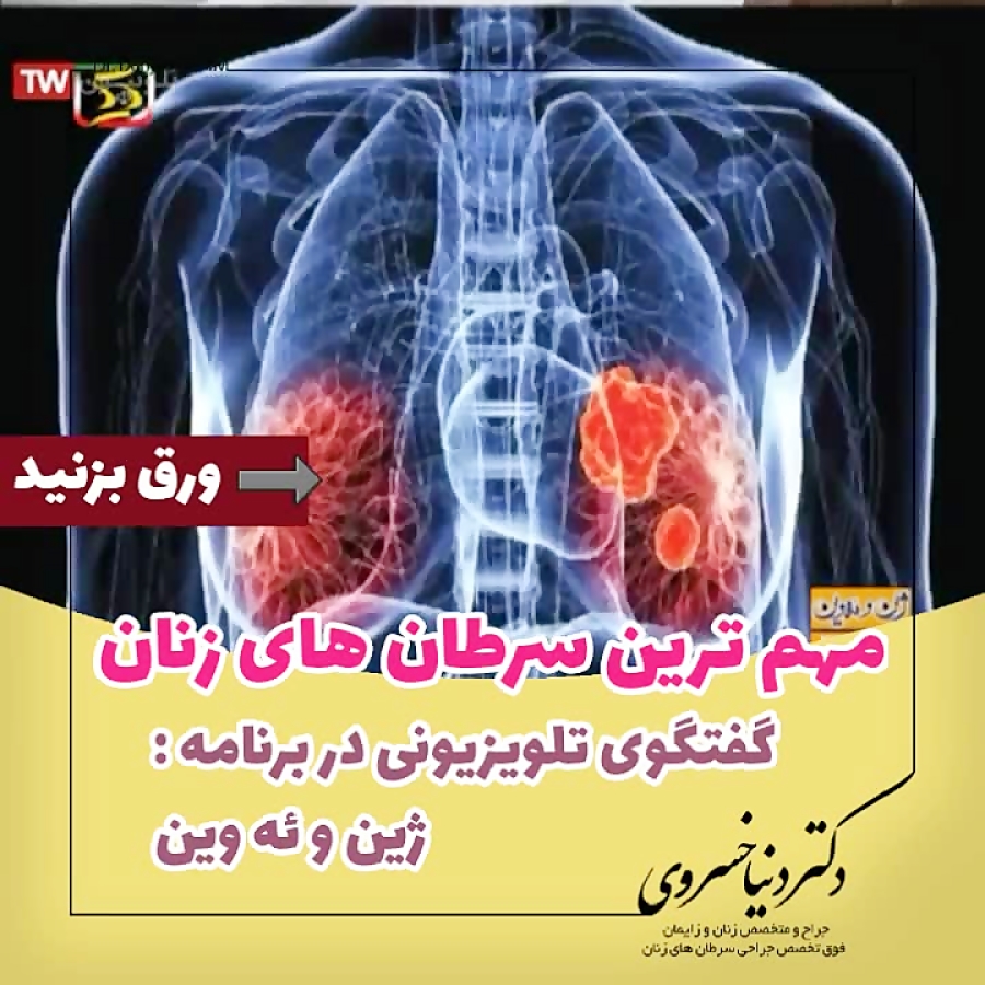 مهمترین سرطان های زنان - ۲