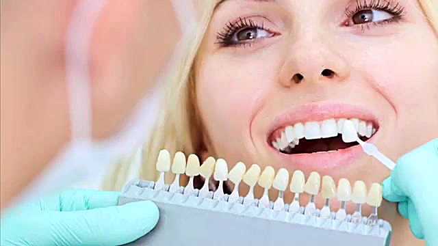 عوامل پنهان بر زیبایی لمینت سرامیکی کلینیک دندانپزشکی دکتر عزیز گشاده رو