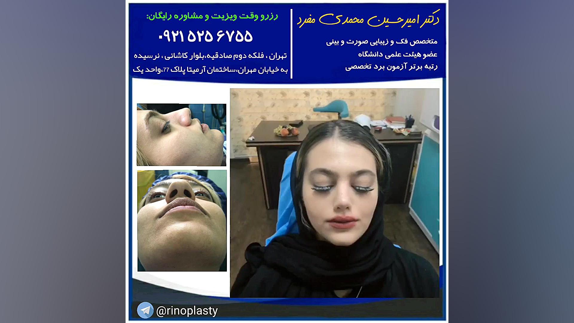 عمل زیبایی بینی (دکتر امیر حسین محمدی مفرد) دکتر امیر حسین محمدی مفرد