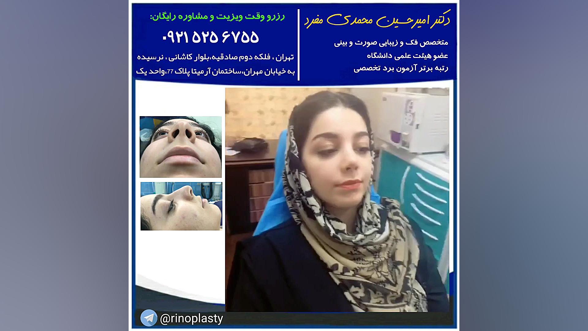 عمل زیبایی بینی (دکتر امیر حسین محمدی مفرد) دکتر امیر حسین محمدی مفرد